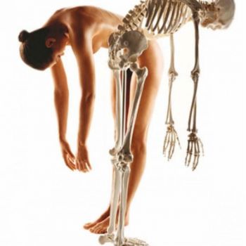 Bone Defect (Osteoporosis)
